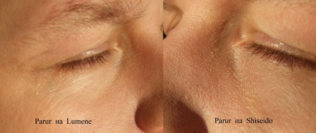 Увлажняющее средство с тоном и защитой Skincare Tinted Moisture Protection SPF20 от Shiseido фото 6 Увлажняющее средство с тоном и защитой Skincare Tinted Moisture Protection SPF20 от Shiseido фото 6